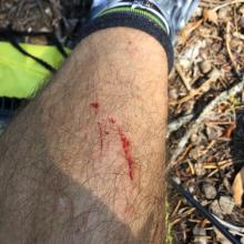 Long pants would be prudent